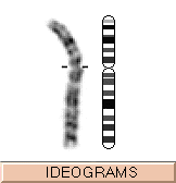 ideograms.gif (2973 bytes)