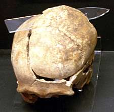 skull wound