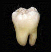 Izgled zuba sa dva korjena